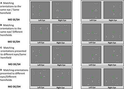 Perceptual Grouping During Binocular Rivalry in Mild Glaucoma